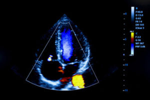POINT OF CARE ULTRASOUND